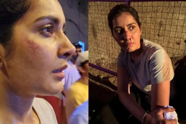 Raashi Khanna : పాత్ర కోసం కఠోర శ్రమ.. గాయాలతో రాశీ ఖన్నా!